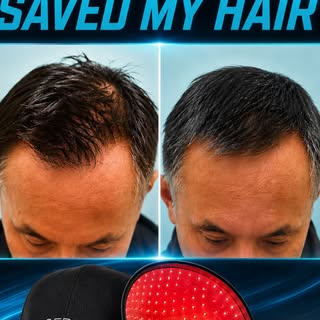 I started noticing a decent amount of hair loss this past year and wanted to try one method to isola