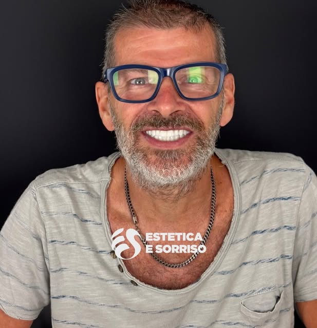 ✨ Un sorriso nuovo, naturale e armonioso 🦷🤍

Un risultato studiato per valorizzare il sorriso, mig