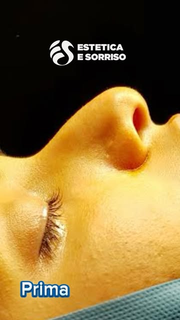 Un risultato più armonioso e proporzionato, studiato per valorizzare i lineamenti del viso mantenend