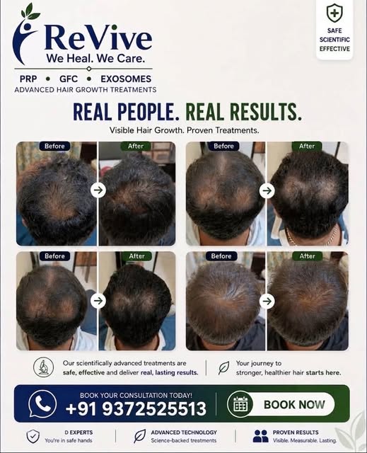 Real people. Real results. Real confidence. 🌿

Hair growth is a journey—and the right treatment can