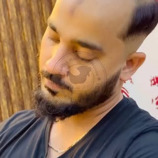 ✨ Regain Your Confidence with Hair Replacement in Ghaziabad ✨

Hair loss can affect your confidence,