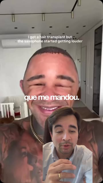 Edema excessivo após o transplante capilar não deve ser considerado normal.

Neste vídeo, o Dr. Raph