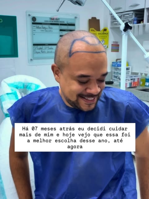 Cada passo que você dá na vida, você define os próximos 

E ter decidido fazer o transplante capilar