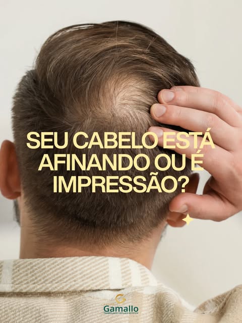 Os primeiros sinais da calvície masculina podem aparecer antes das entradas ficarem evidentes.

Na a
