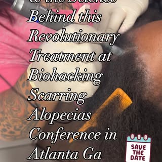For Scarring Alopecia Sufferers: Learn, Connect, and Heal
October 26, 2025 | Atlanta, Georgia

Are y