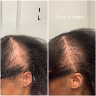 ✨ What Happens During Cranial Release? Watch the Ears! 👂🧠

One of the most fascinating things I ob