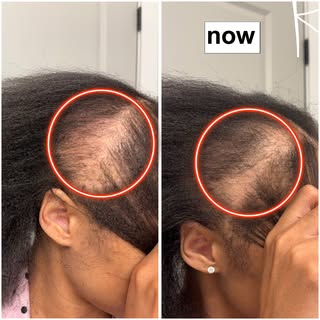 Just 4 Weeks In… and She’s Taking Control of Her CCCA! ✨

Every journey begins with understanding th