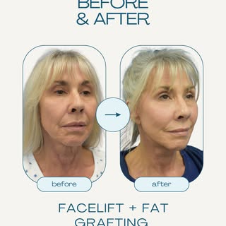 The Facial and Body Surgery Center: results that speak for themselves. 

Contact us today to book a 