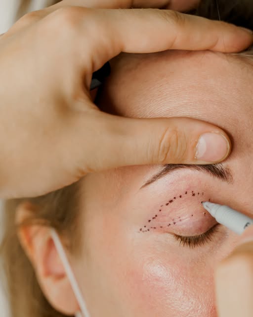 One of the most noticeable spots on our face as we age is around our eyes. 

Looking to give yoursel