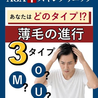 👨‍⚕️ あなたはどのタイプ？薄毛の進行3タイプ💡

AGAの進行パターンは、大きく分けて3つあります。

✔️ 生え際の両端から後退する「M字型」
✔️ 頭頂部から薄くなる「O字型」
✔️ 前頭