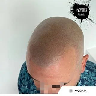 SMP in HD 😍🔥 loved creating this super natural result for this beautiful man who flew from Sydney 
