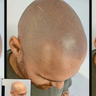 Look closely ~ Scalp micropigmentation is both an Art and a Science 🎨🔬
Choose your SMP artist care