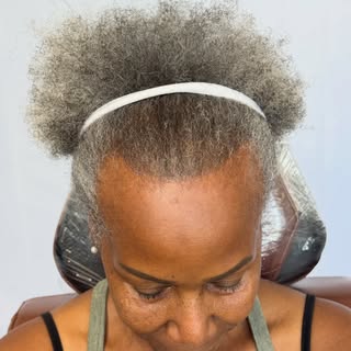 Female Hair Density SMP 

 Hair doesn’t always mean you need to change your hairstyle. Scalp Micropi