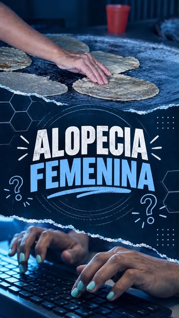 La caída de cabello en mujeres no se ve igual que en hombres — y por eso muchas lo detectan tarde. S