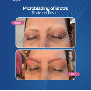 ✨💖 Beautiful Brows. Effortlessly Defined. 💖✨

Transform sparse, uneven brows into naturally fuller