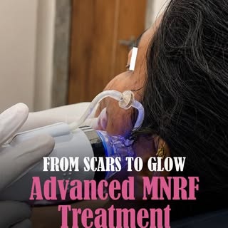✨💙 Smooth Skin Starts From Within. 💙✨

Acne scars, open pores, uneven skin texture, and fine lines