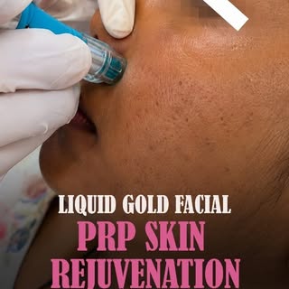 ✨🩸 Unlock Your Skin's Natural Glow With PRP Therapy 🩸✨

Still relying on expensive skincare produc