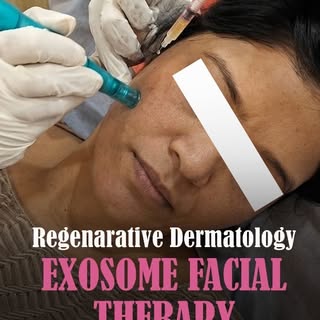 ✨🌿 Rejuvenate Your Skin From Within With Exosome Therapy ✨

Healthy, radiant skin starts at the cel