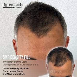 By reducing the contrast from scalp to hair, you get fuller looking hair.

Text a few photos for an 