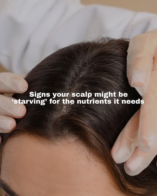 Your hair can sometimes give you clues about what’s going on internally 👀

Changes like increased s