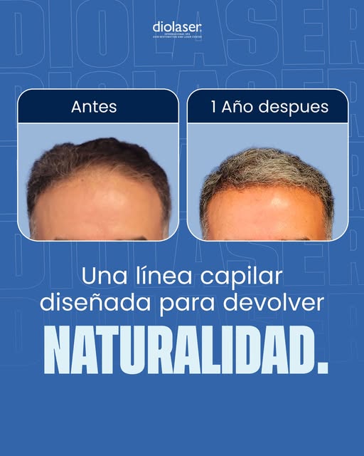 ¿Qué estás esperando? No lo pienses más!
Agenda tu CITA 👇
https://bit.ly/Diolaserpr
Visítanos en
ht