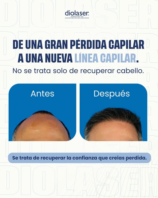 ¿Qué estás esperando? No lo pienses más!
Agenda tu CITA 👇
https://bit.ly/Diolaserpr
Visítanos en
ht