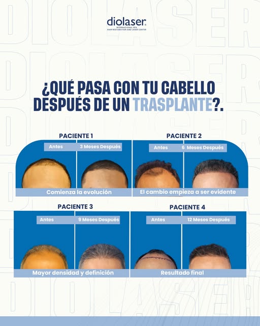 ¿Qué estás esperando? No lo pienses más!
Agenda tu CITA 👇
https://bit.ly/Diolaserpr
Visítanos en
ht
