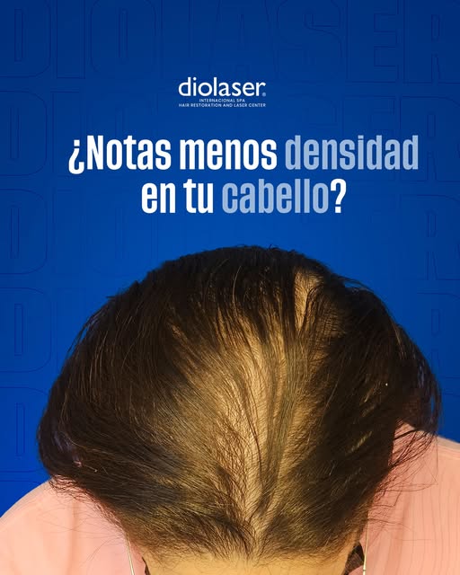 El PRP capilar puede ayudar a fortalecer el cuero cabelludo y estimular el crecimiento del cabello.
