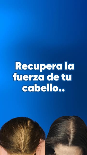 ¿Qué estás esperando? No lo pienses más!
Agenda tu CITA 👇
https://bit.ly/Diolaserpr
Visítanos en
ht