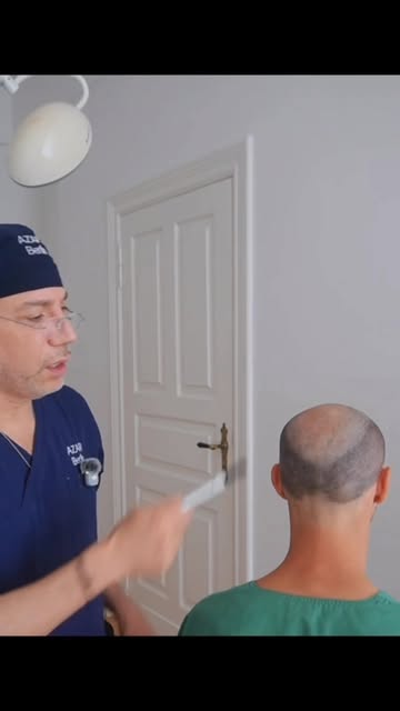 Bevor ich ein Haar entnehme, muss der Haarausfall stehen.

Erblich bedingter Haarausfall ist progred
