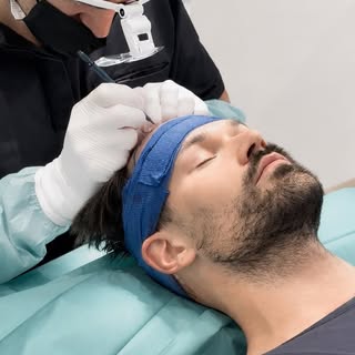 ✨ Jede Haartransplantation beginnt mit einer sorgfältigen Planung.
Gemeinsam mit dem behandelnden Ar