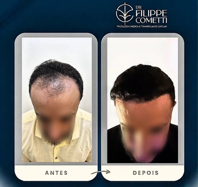 Um novo começo para quem quer voltar a se sentir bem com o próprio cabelo. ✨

Quer saber se o transp