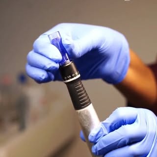 Microneedling isn’t just about tiny needles—it’s about stimulating your skin’s natural healing proce