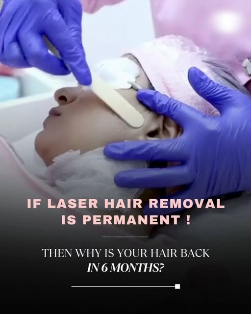 If LHR is permanent, then why does hair grow back after 6 months? 🤔

Laser Hair Reduction doesn’t m