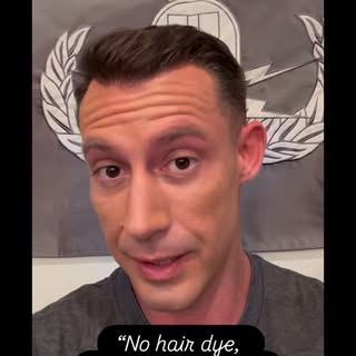 “No hair dye… just hair MOVED!” 
—J.J.Jones @johnny_joey 

@baumanmedical #HairMovers 
#HairTranspla