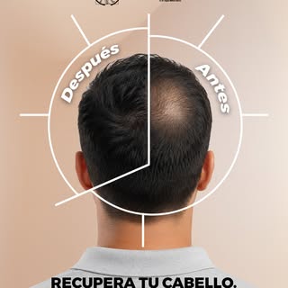 Recupera tu cabello. Recupera tu confianza.

En Human Boost Clinic contamos con tratamientos persona