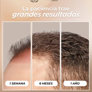 Los buenos resultados toman tiempo. ✨

Cada tratamiento tiene un proceso y una evolución diferente. 