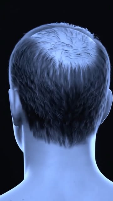 LA CALVICIE NO ES LO QUE CREES. 🧬
No empieza cuando pierdes el cabello. La DHT puede afectar progre