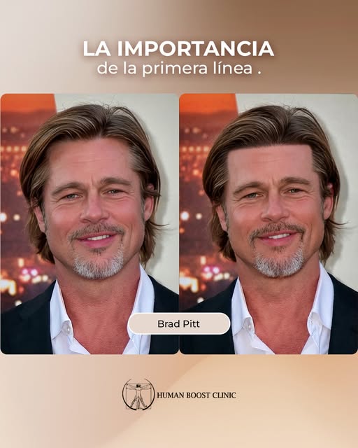 Una primera línea puede cambiar por completo la percepción de un rostro.

Su diseño considera propor
