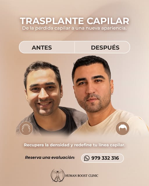 Trasplante capilar
De la pérdida capilar a una nueva apariencia.
Recupera densidad, redefine tu líne