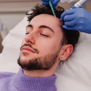 ✨Découvrez les bienfaits de la mésothérapie capillaire, une solution innovante pour revitaliser vos 