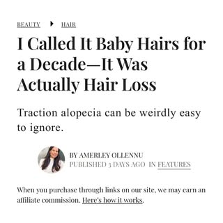 Thank you to @amerleyollennu for detailing treatment options for traction alopecia #hairloss - https