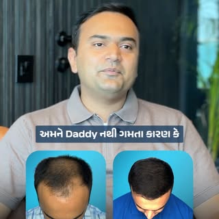 Does hair loss make you look like a different person? 🧔‍♂️

Mounin Desai, a General Manager in Sura
