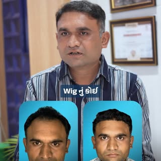 Thinking about a hair wig? Don't make that mistake! 🛑

Bhaveshbhai almost chose a wig for his reced