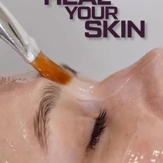 Acne, pimples, dark spots, and scars aren't just skin concerns—they can affect your confidence too. 