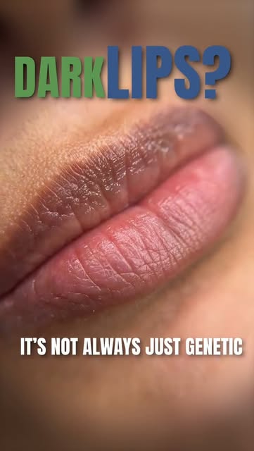 Dark lips are not always genetic. 👄

Sometimes, your lips may be trying to tell you something. From