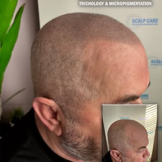 Another happy customer! 
Find out more on thescalpcare.com