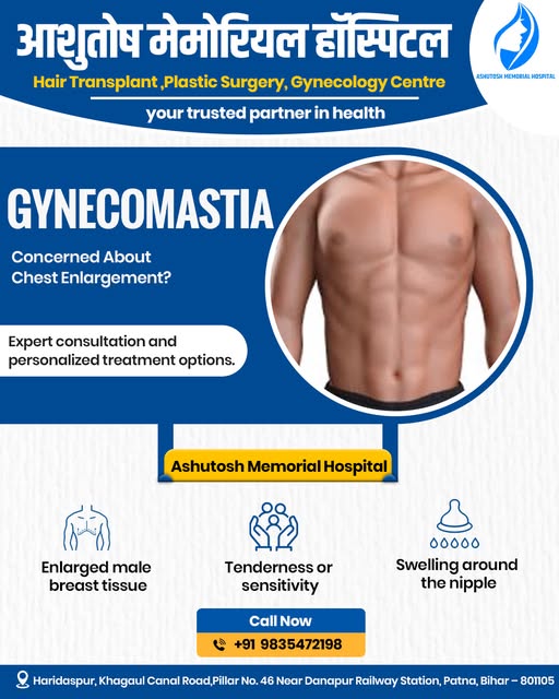 Gynecomastia can cause enlarged male breast tissue, tenderness, or swelling around the nipple. Get t