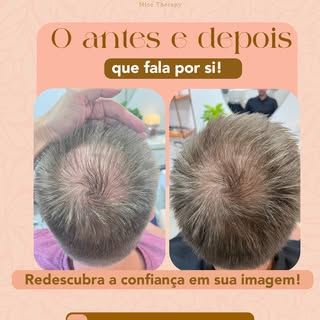 ✨ Cada avanço merece ser celebrado.

Quando o tratamento é direcionado para a causa do problema, os 