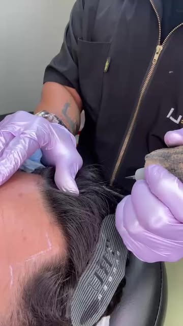 Smp session/Hairline Reconstruction 🪄